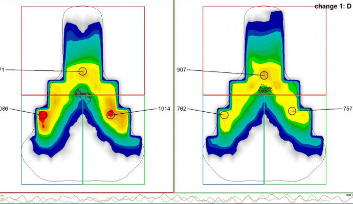 Bikefitting - Velozette Nr. 10